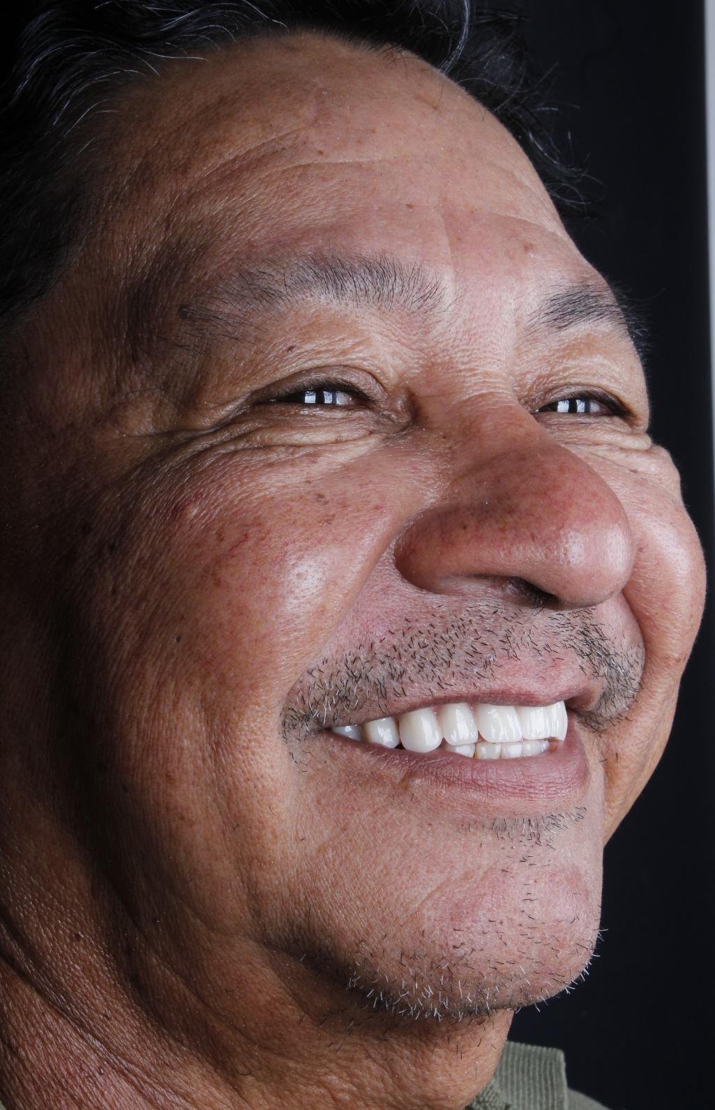 Protocolo All-on-Four