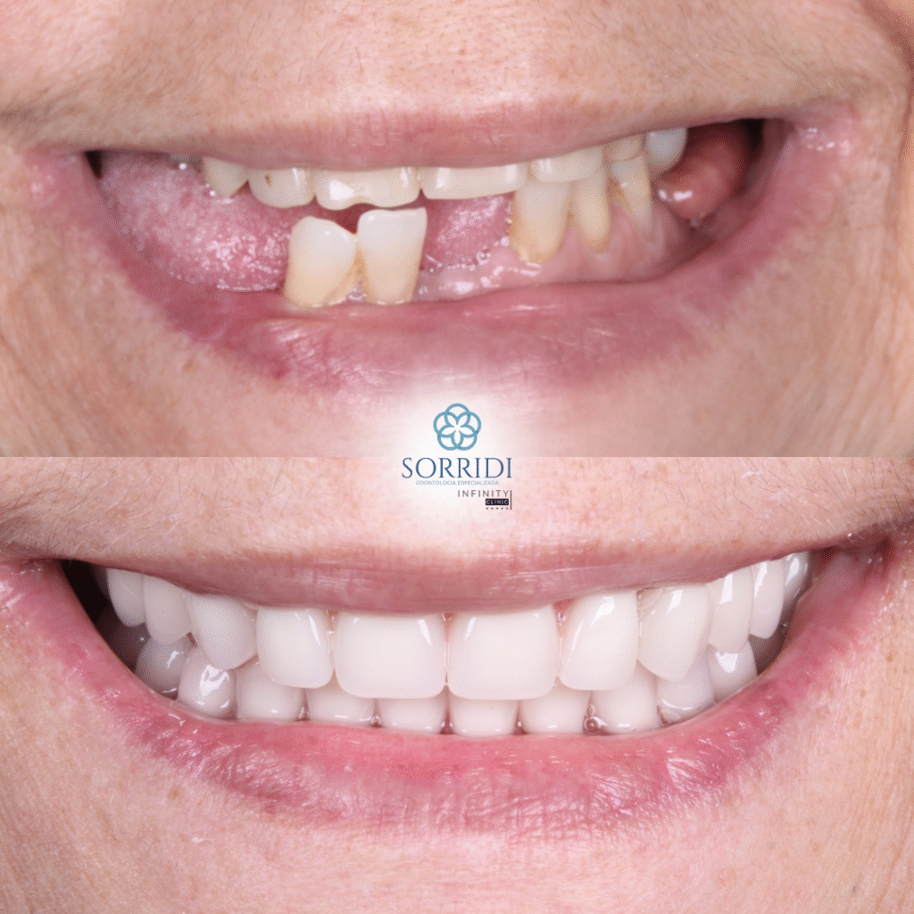 protocolo superior e inferior