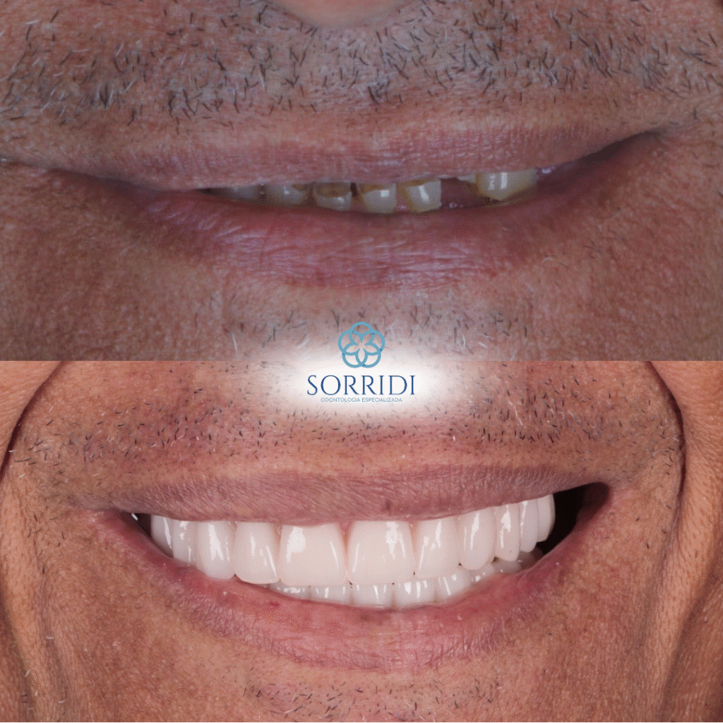 protocolo superior e inferior