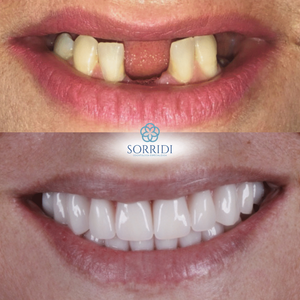 protocolo superior e inferior