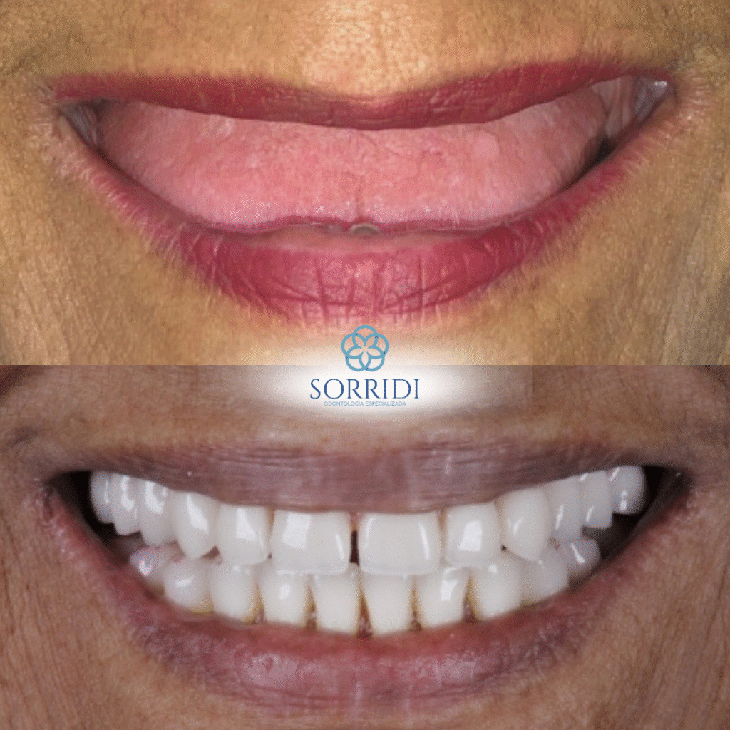 protocolo superior e inferior