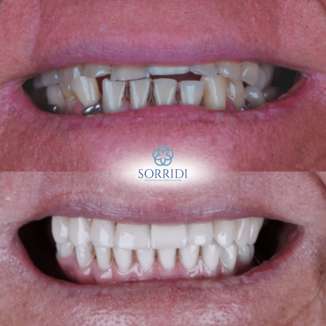 protocolo superior e inferior