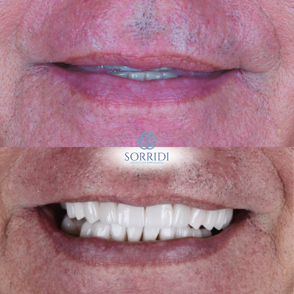 protocolo superior e inferior