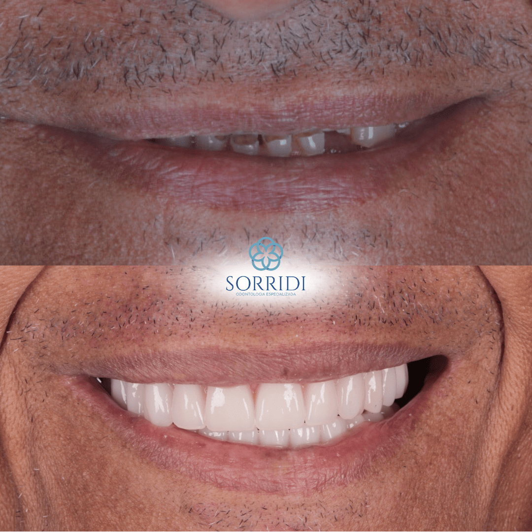 protocolo superior e inferior