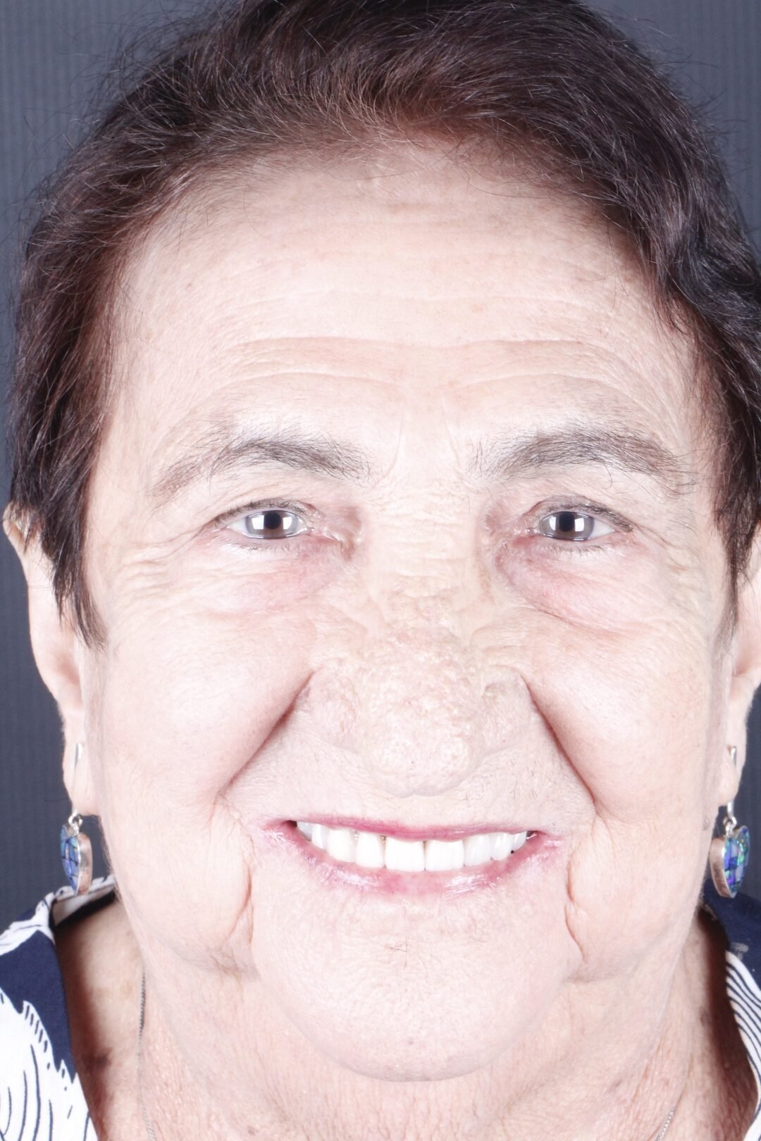 pacientefoto-13364796