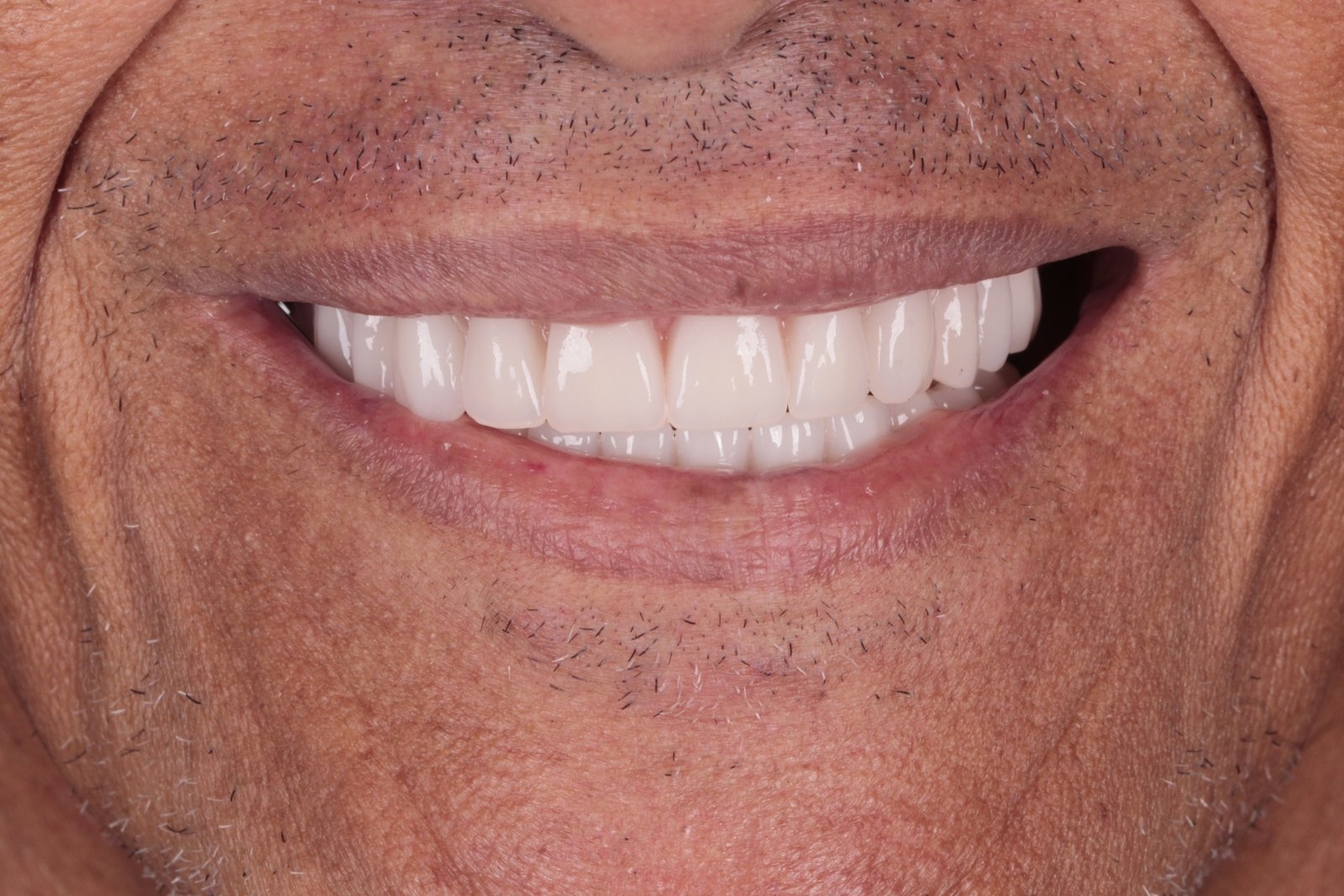 pacientefoto-14121519