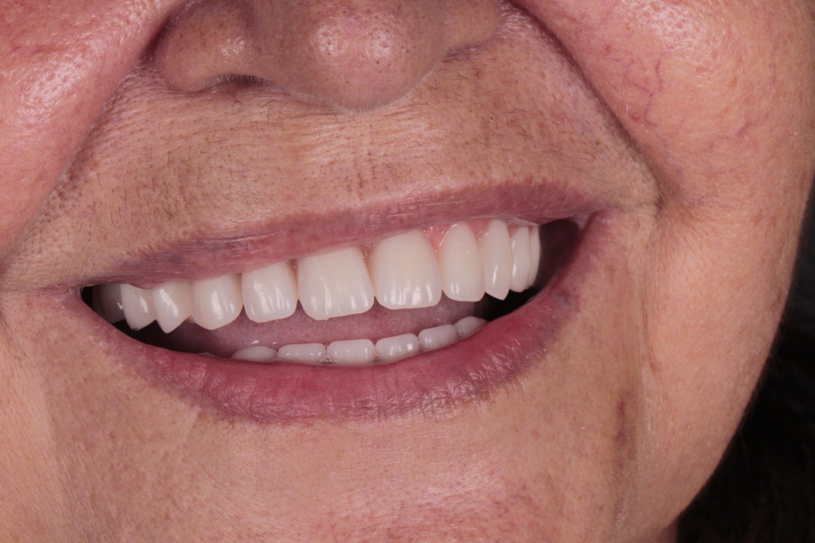 pacientefoto-14174857