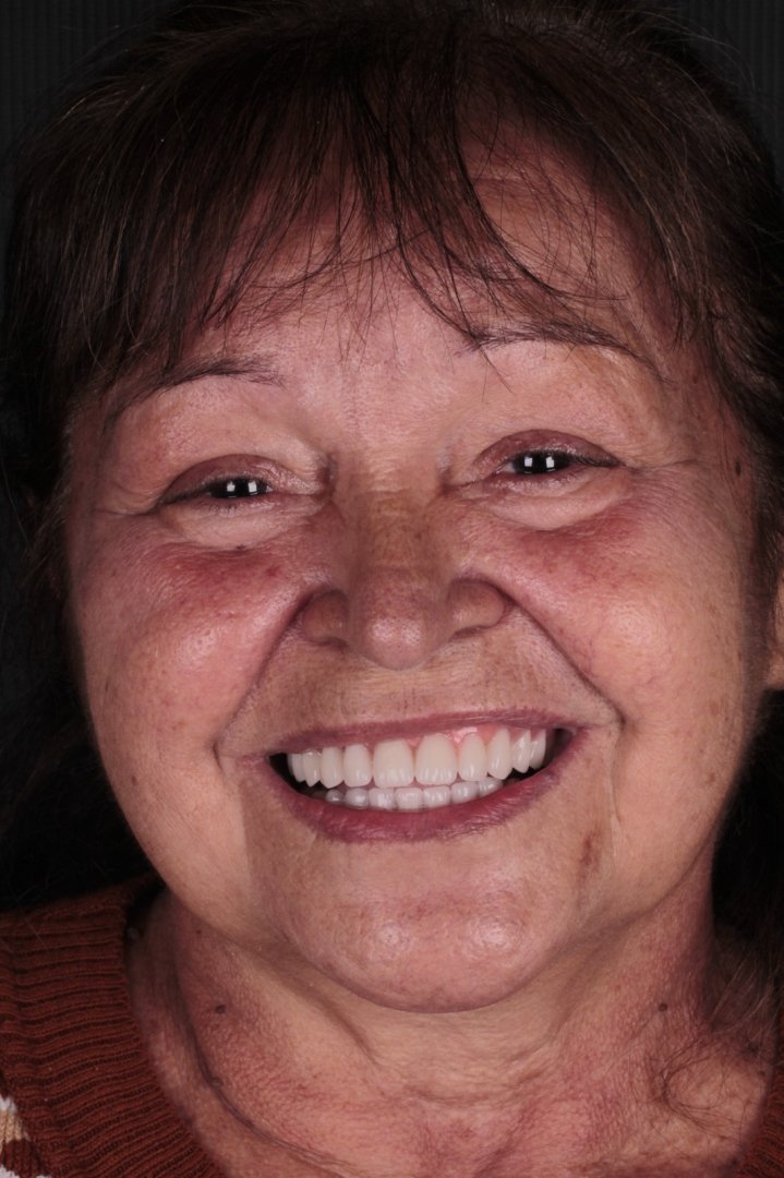 pacientefoto-14174861