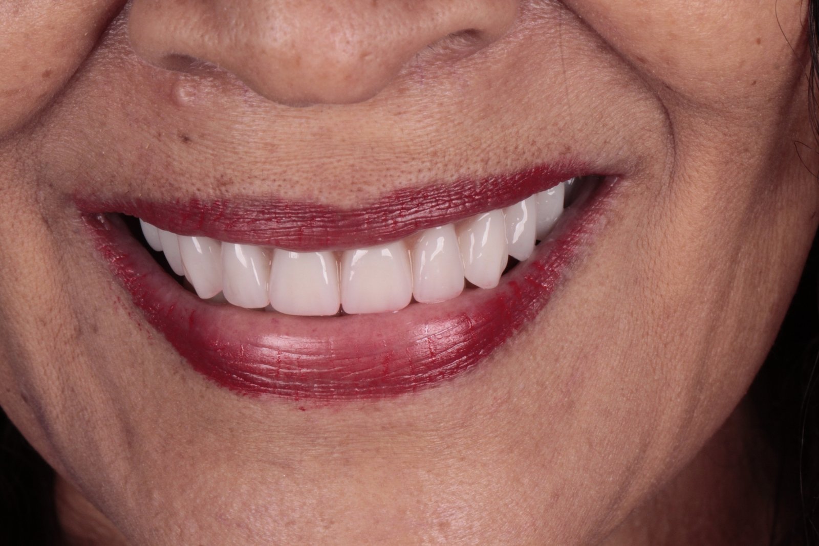 pacientefoto-14372089