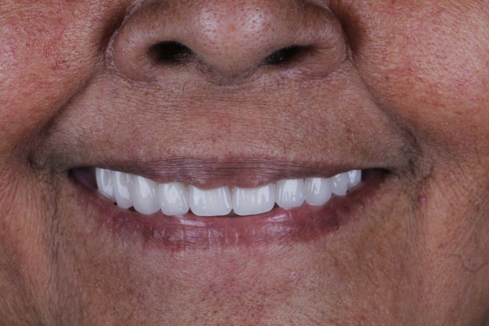 pacientefoto-14866203