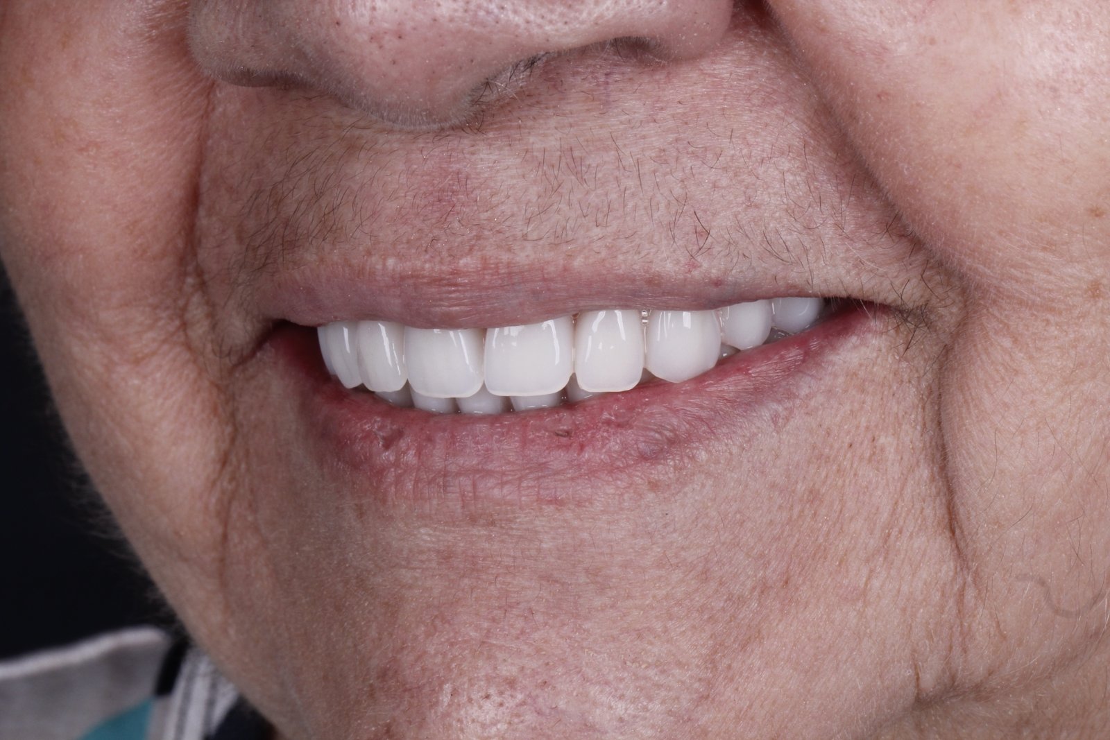 pacientefoto-14901492