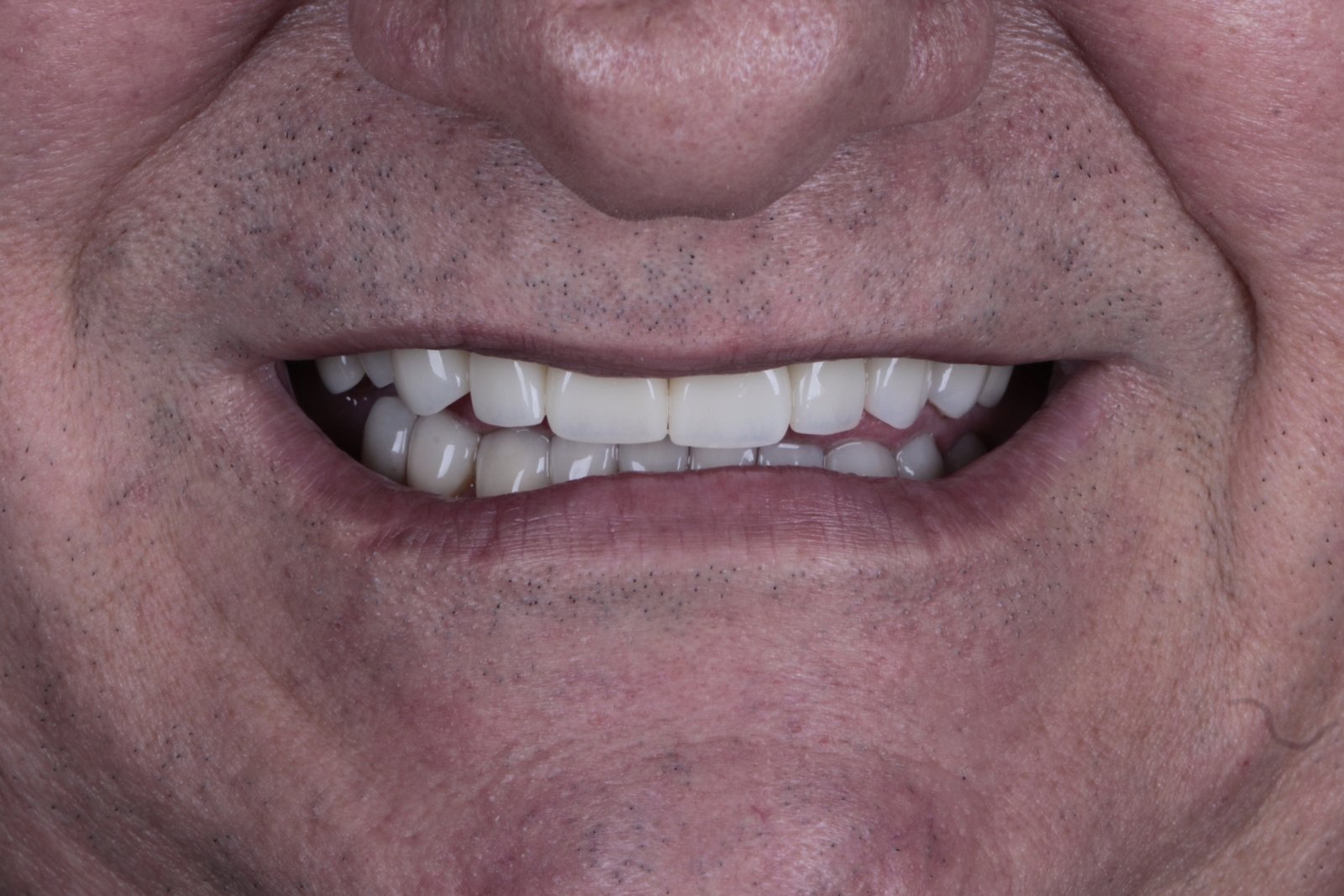 pacientefoto-15036916