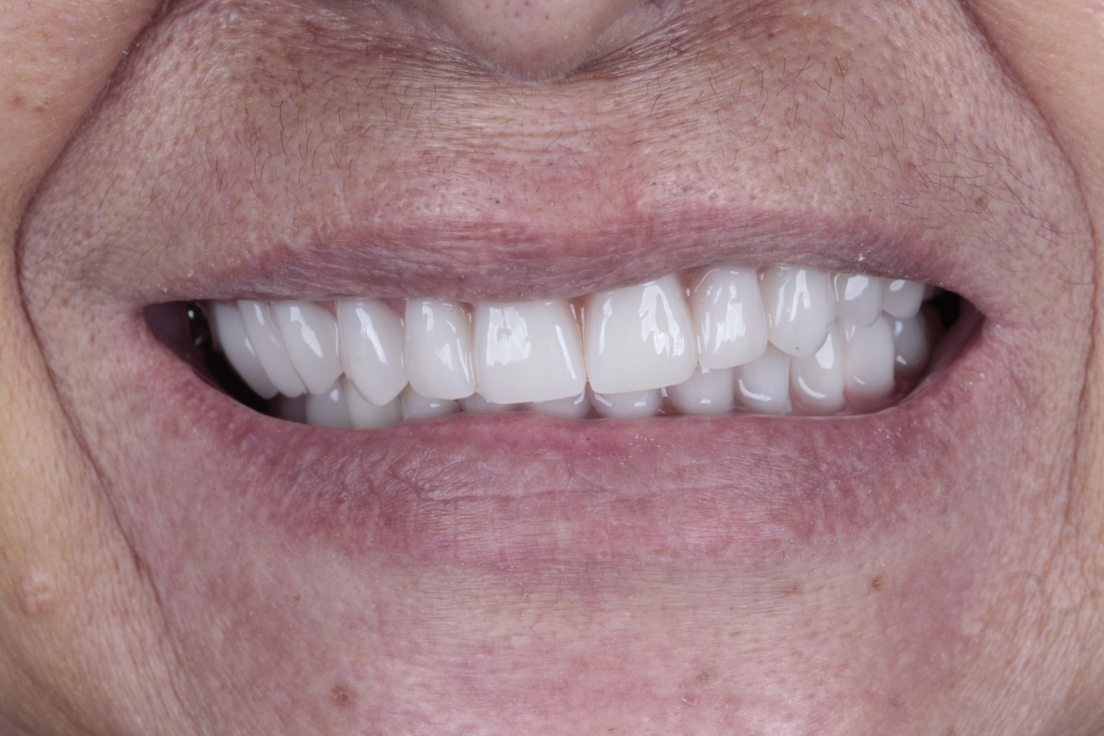 pacientefoto-15053104