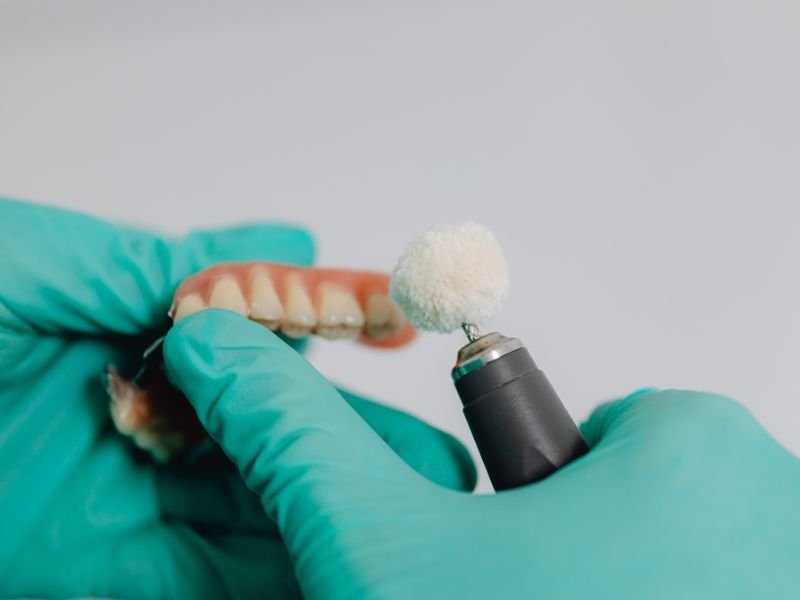 como-limpar-protese-sobre-implante