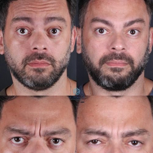 Harmoniza&ccedil;&atilde;o Orofacial